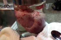 The Heart in a Jar